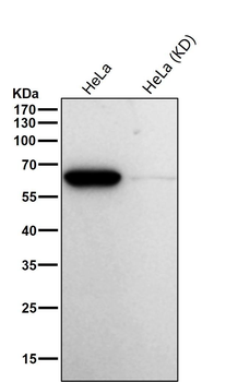 ACADVL/VLCAD Antibody