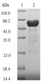 Bacterial porB protein