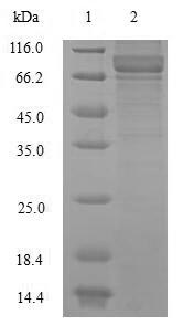 Human NEFL protein