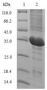 Primate IL2 protein