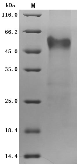 Recombinant Human IGF-like family receptor 1 (IGFLR1), partial (Active)
