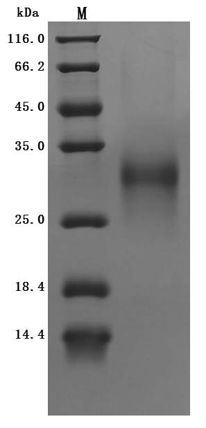Recombinant Human HLA class II histocompatibility antigen gamma chain (CD74), partial (Active)