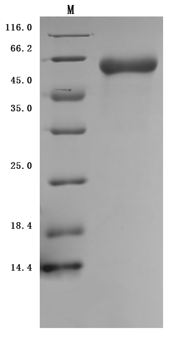 Recombinant Human Inactive tyrosine-protein kinase transmembrane receptor ROR1 (ROR1), partial (Active)