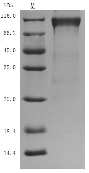 Recombinant Human Heat-stable enterotoxin receptor (GUCY2C), partial (Active)