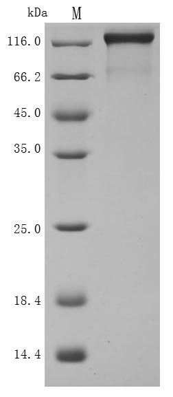 Recombinant Human Semaphorin-4D (SEMA4D), partial (Active)