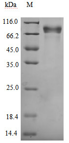 Recombinant Human Growth hormone receptor (GHR), partial, Biotinylated (Active)