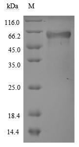 Recombinant Human Tumor necrosis factor receptor superfamily member 1A (TNFRSF1A), partial (Active)