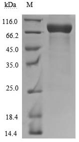 Recombinant Human CD226 antigen (CD226), partial (Active)