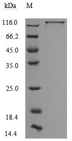 Recombinant Human Neural cell adhesion molecule L1 (L1CAM), partial (Active)