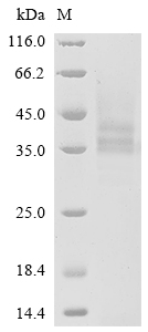 Recombinant Human Poly [ADP-ribose] polymerase 14 (PARP14), partial