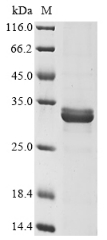 Recombinant Escherichia coli Cytolethal distending toxin subunit A (cdtA)
