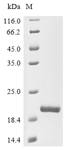 Recombinant Human Tumor susceptibility gene 101 protein (TSG101), partial