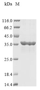 Recombinant Human SPRY domain-containing SOCS box protein 1 (SPSB1)