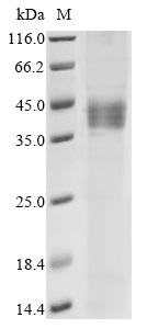 Recombinant Human Receptor for retinol uptake STRA6 (STRA6), partial