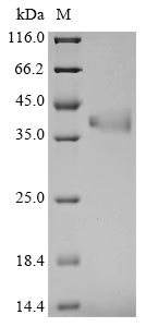 Recombinant Mouse Fructose-bisphosphate aldolase C (Aldoc)