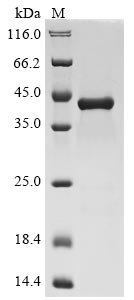 Recombinant Human C-X-C motif chemokine 2 (CXCL2)