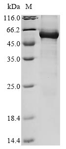 Recombinant Human Werner syndrome ATP-dependent helicase(WRN),partial
