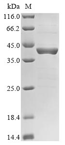 Recombinant Human Forkhead box protein M1 (FOxM1), partial