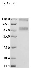 Recombinant Human Cystine/glutamate transporter (SLC7A11) (Active)