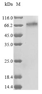 Recombinant Human Integrin beta-like protein 1 (ITGBL1)