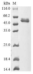 Recombinant Human Prolactin (PRL)