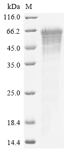 Recombinant Human Osteopontin (SPP1)