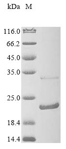 Recombinant Mouse Anterior gradient protein 2 homolog (Agr2)