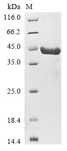 Recombinant Human Sestrin-3 (SESN3)