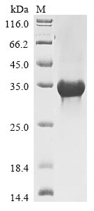 Recombinant Human SPRY domain-containing SOCS box protein 1 (SPSB1)