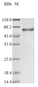 Recombinant Human Vitronectin (VTN)