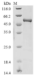 Recombinant Human AP-2 complex subunit mu (AP2M1)