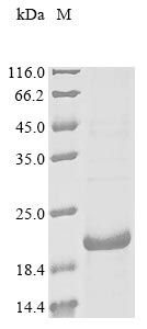 Recombinant Mouse Gastric inhibitory polypeptide receptor (Gipr), partial