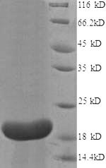 Recombinant Human Interleukin-18-binding protein (IL18BP), partial