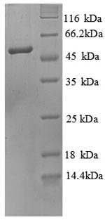 Recombinant Human O-phosphoseryl-tRNA (Sec) selenium transferase (SEPSECS), partial