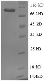 Recombinant Human Endoplasmin (HSP90B1), partial