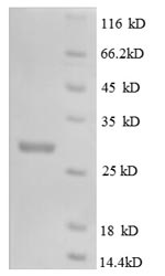 Recombinant Mouse Macrophage colony-stimulating factor 1 (Csf1), partial