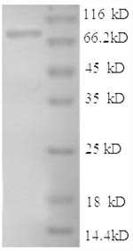 Recombinant Human Intercellular adhesion molecule 1 (ICAM1), partial