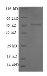 Recombinant Human Interstitial collagenase (MMP1), partial
