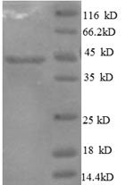 Recombinant Human Interleukin-10 (IL10)