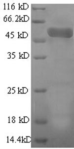 Recombinant Human Actin-related protein 2/3 complex subunit 2 (ARPC2), partial