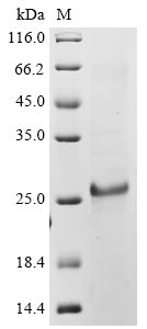 Recombinant Human coronavirus OC43 Protein I (N)