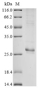 Recombinant Bovine coronavirus Protein I (N)