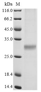 Recombinant Severe acute respiratory syndrome coronavirus 3C-like proteinase, partial