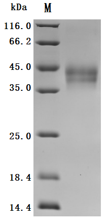 Human DKK1 Protein