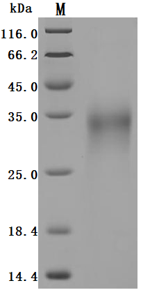 Human GLP1R Protein