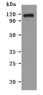 Human PROM1-VLPs Protein