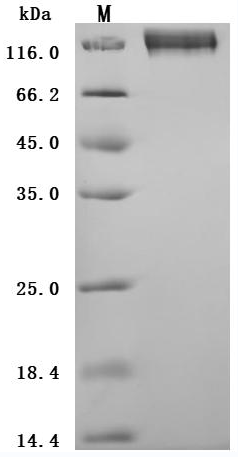 Human CEACAM5 Protein