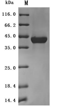 Human VSIG4 Protein
