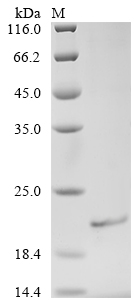 Human AMFR Protein