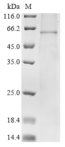 Mumps virus Hemagglutinin-neuraminidase Protein